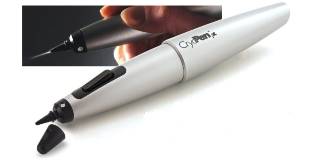 Cryopen for hyperpigmented lesions